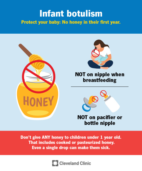 Baby Formula Recall Raises Concerns Over Infant Botulism