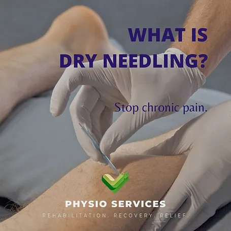 Unraveling the Mystery of Dry Needling: Treatment, Risks, and Recent Incidents
