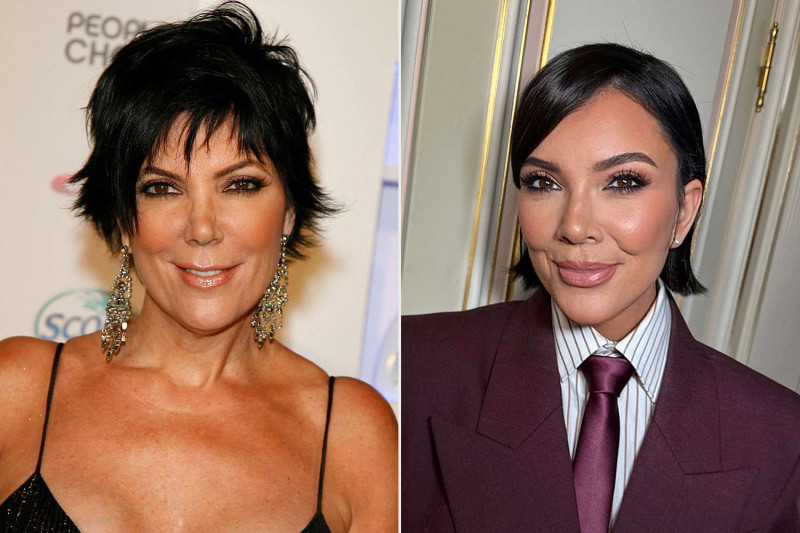 Kris Jenner's Facelift: The Kardashian Matriarch's Transformation and the Debate