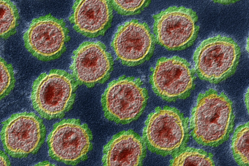 The Super Flu Surge of 2026: Understanding the New H3N2 Variant and Its Impact on Public Health