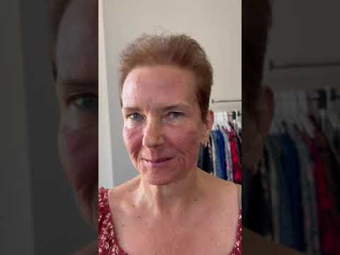 Perez Hilton's Health Crisis: Unraveling the Mystery