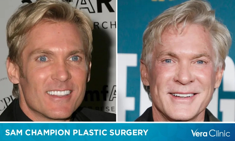 Sam Champion's Heart Surgery: A Weathered Anchor's Battle for Recovery